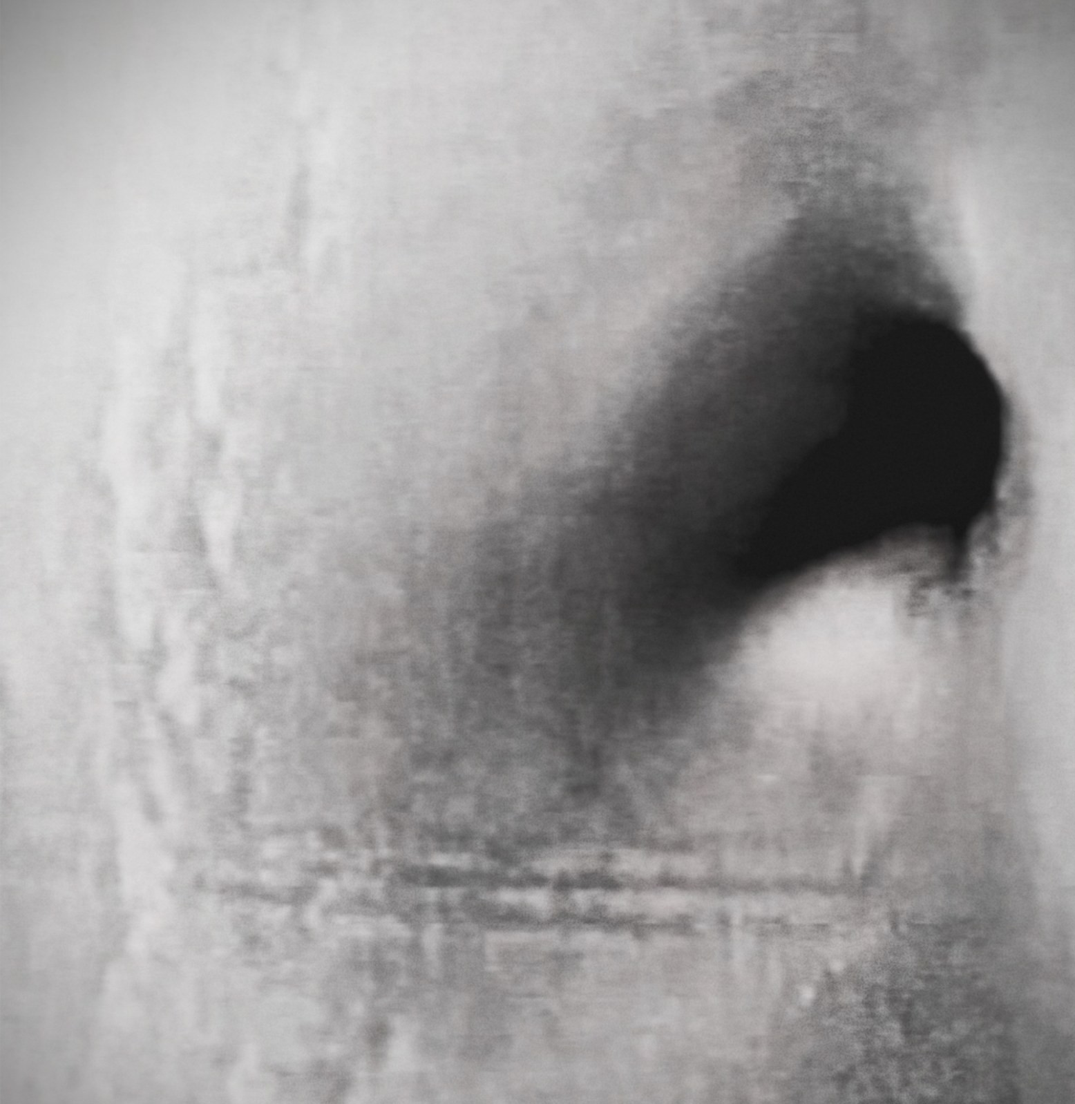 Relative: Striation. The body.