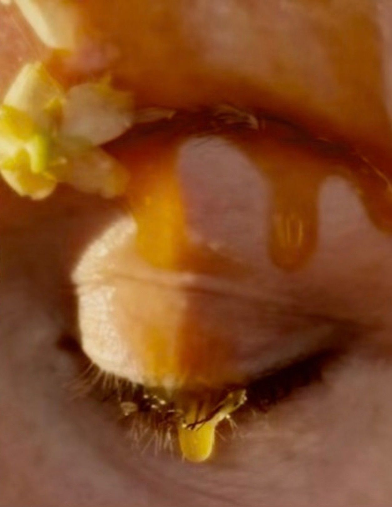Taste and See, 1 of 5. Close crop of a closed eye; honey runs over the lid and a drop hangs from the lashes, a small white flower at the brow.